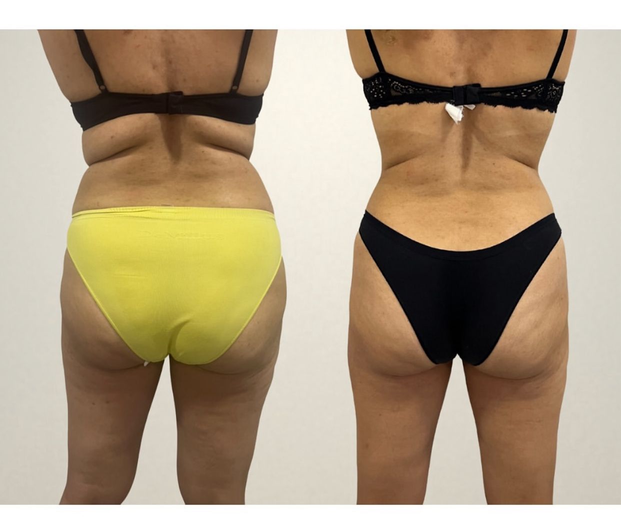 WhatsApp Image 2025-07-01 at 8.01.52 PM (1)