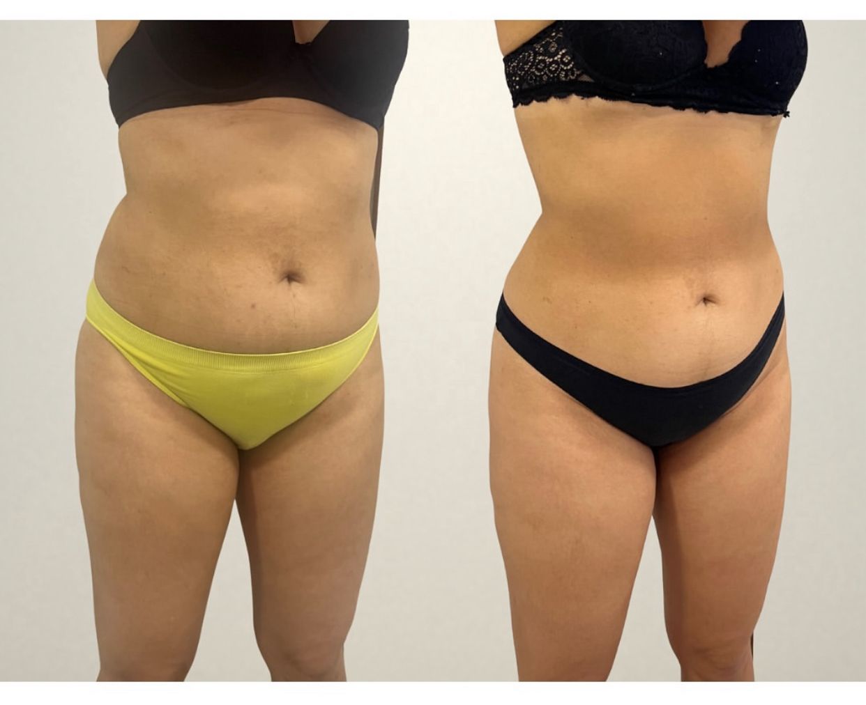 WhatsApp Image 2025-07-01 at 8.01.52 PM (2)