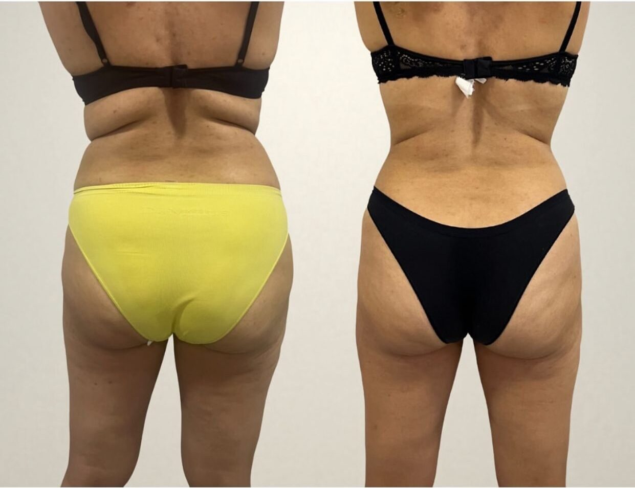 WhatsApp Image 2025-07-01 at 8.01.52 PM (3)