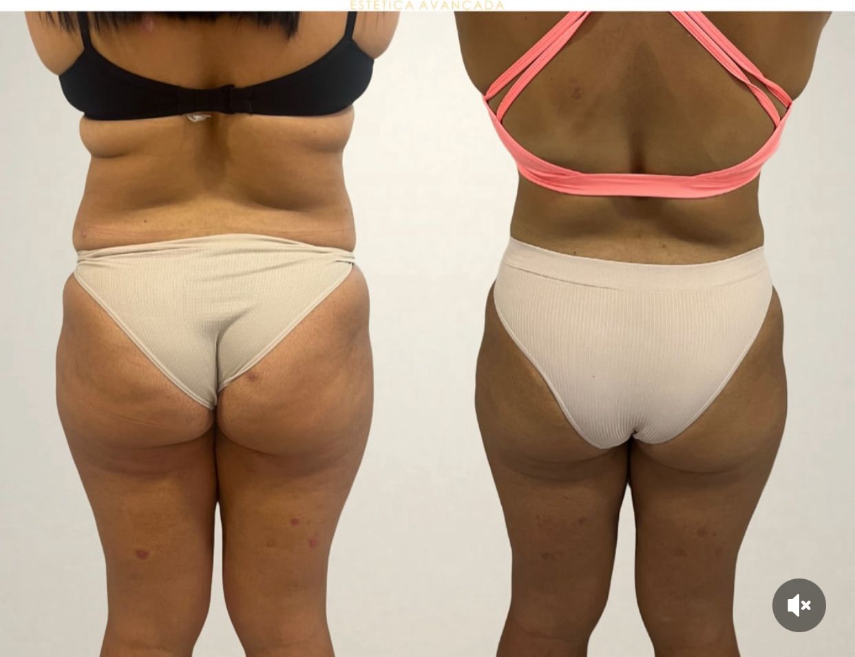 WhatsApp Image 2025-07-01 at 8.01.52 PM