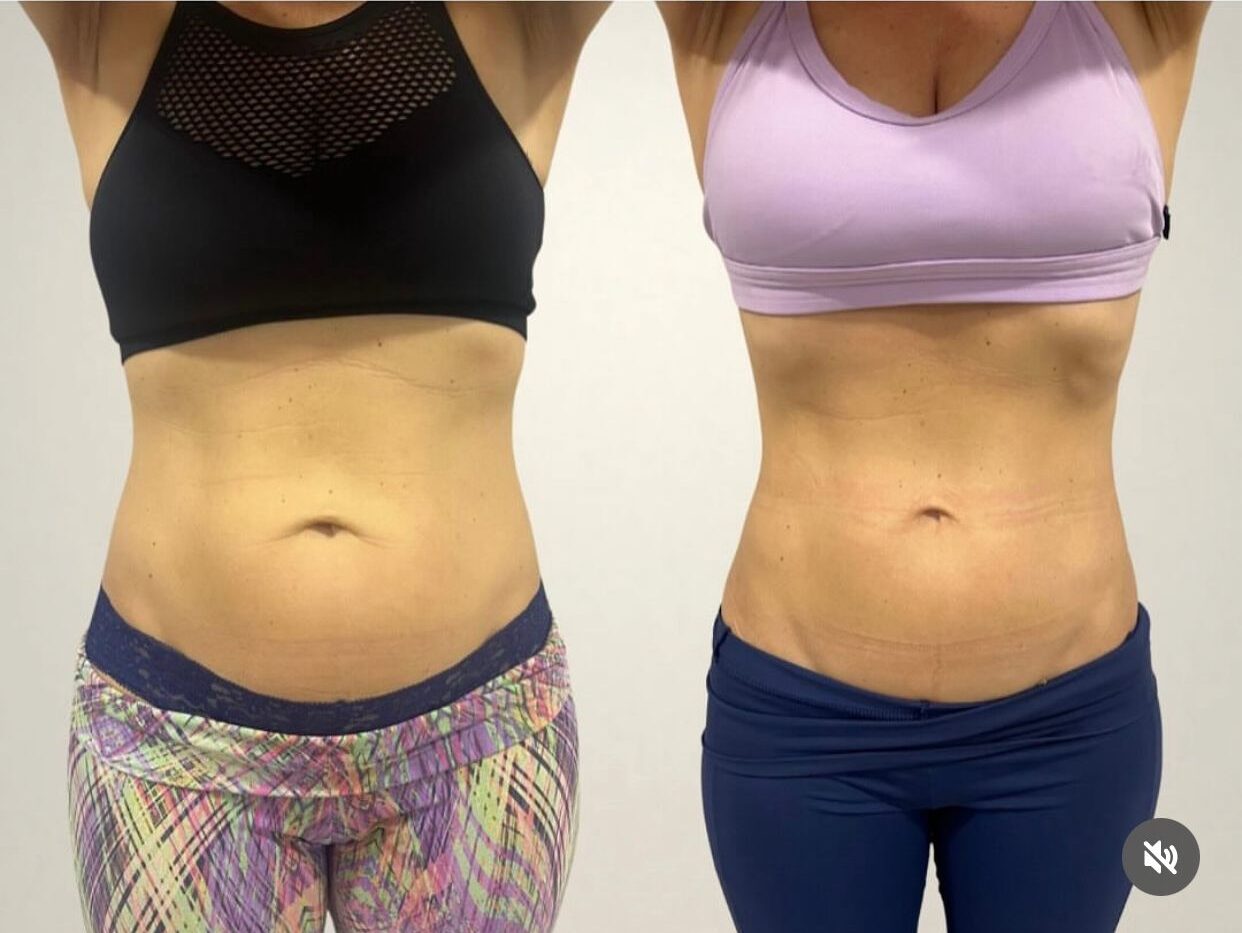 WhatsApp Image 2025-07-01 at 8.05.02 PM